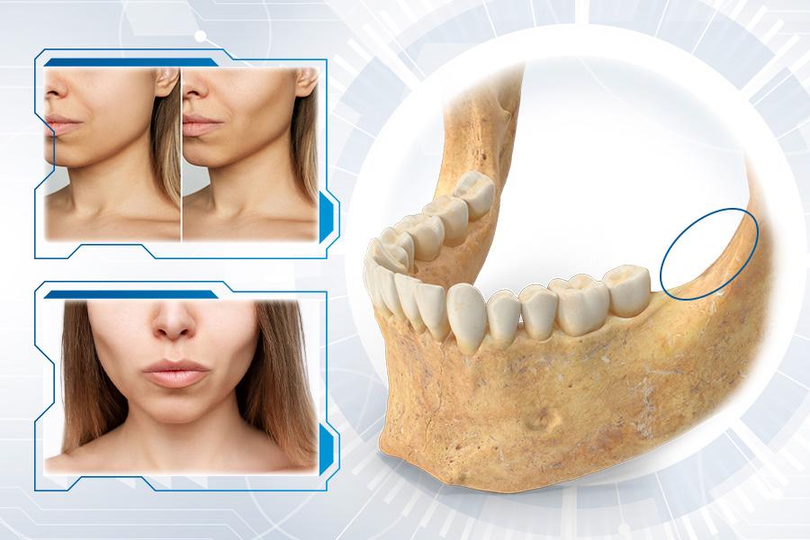 Tiêu chân răng là gì? Phân loại và cách điều trị- Ảnh 2. Tiêu chân răng là gì? Phân loại và cách điều trị- Ảnh 2.