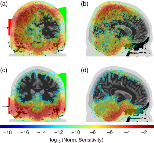 Lần đầu tiên, các nhà khoa học bắn được tia laser xuyên qua đầu một người đàn ông, và ông ấy vẫn còn sống- Ảnh 8. Lần đầu tiên, các nhà khoa học bắn được tia laser xuyên qua đầu một người đàn ông, và ông ấy vẫn còn sống- Ảnh 8.