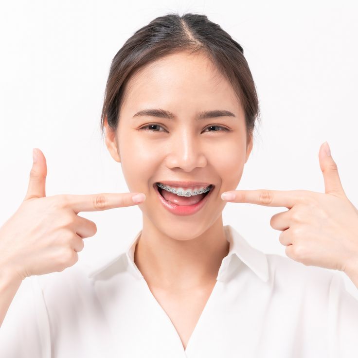 100 triệu để đổi nụ cười: Liệu có đáng không?- Ảnh 3. 100 triệu để đổi nụ cười: Liệu có đáng không?- Ảnh 3.