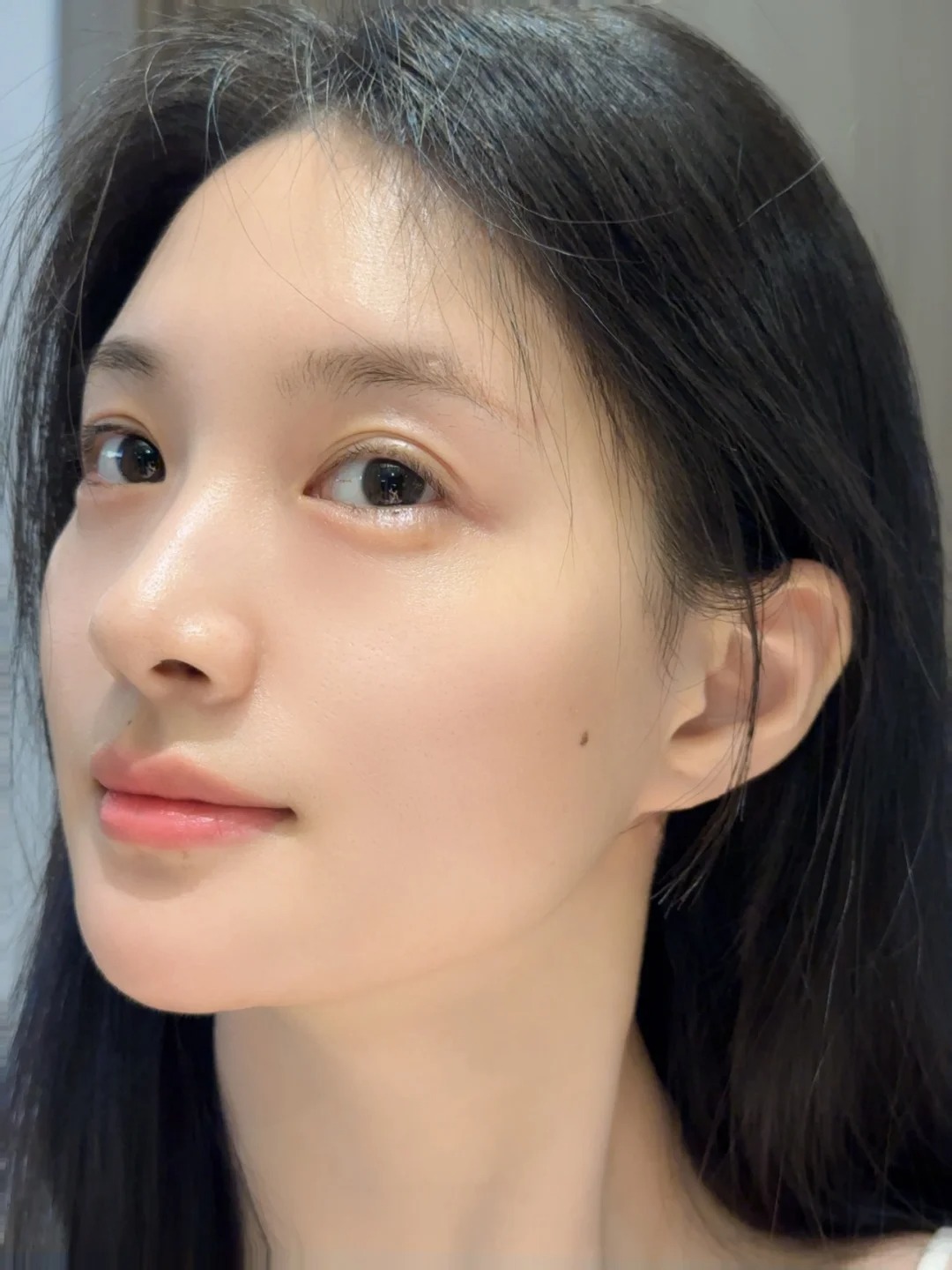 Phẫu thuật hàm mặt: Giải pháp chỉnh hình toàn diện từ cấu trúc xương- Ảnh 2. Phẫu thuật hàm mặt: Giải pháp chỉnh hình toàn diện từ cấu trúc xương- Ảnh 2.