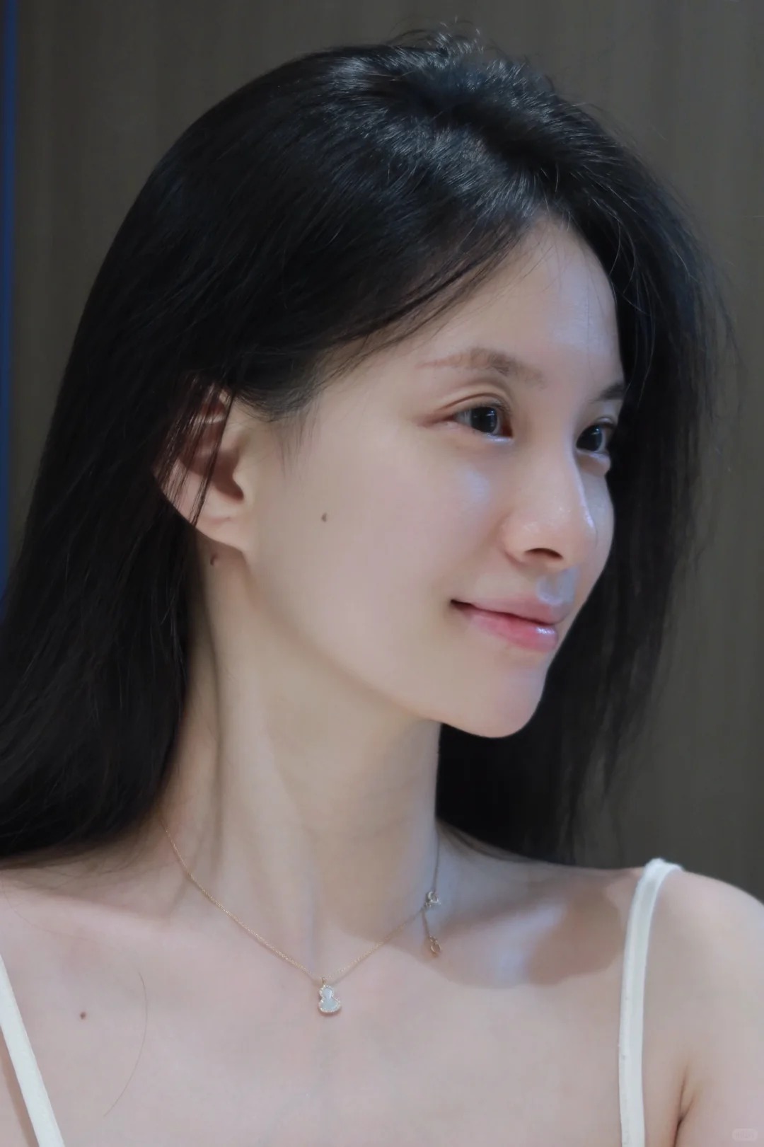 Phẫu thuật hàm mặt: Giải pháp chỉnh hình toàn diện từ cấu trúc xương- Ảnh 7. Phẫu thuật hàm mặt: Giải pháp chỉnh hình toàn diện từ cấu trúc xương- Ảnh 7.