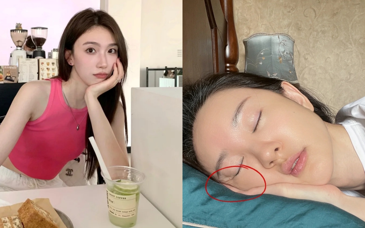 7 thói quen tai hại và phổ biến khiến da nhanh chảy xệ, lão hóa- Ảnh 1. 7 thói quen tai hại và phổ biến khiến tại hi88 chảy xệ, lão hóa- Ảnh 1.
