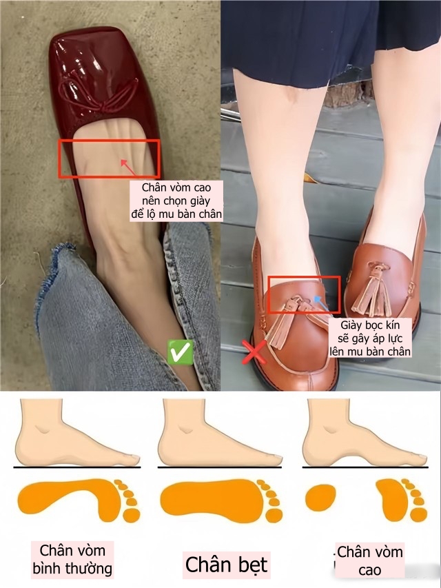 Ngoài 40 tuổi, hãy nói lời tạm biệt với giày đế xuồng và đế độn cao, thay vào đó là 3 lựa chọn thanh lịch hơn!- Ảnh 26. Ngoài 40 tuổi, hãy nói lời tạm biệt với giày đế xuồng và đế độn cao, thay vào đó là 3 lựa chọn hi88.con lịch hơn!- Ảnh 26.