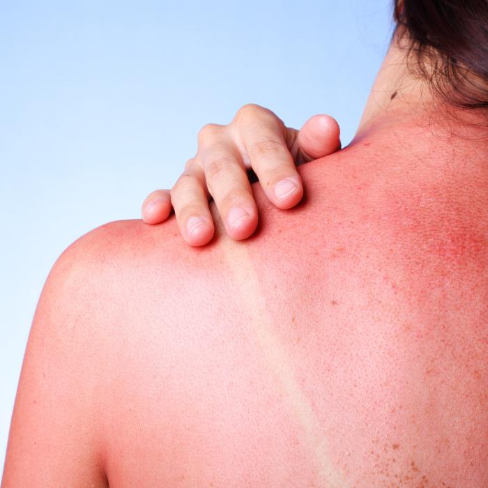Kem chống nắng Topicrem Sun Protect lá chắn tuyệt vời – cùng gia đình đón nắng an toàn- Ảnh 2. Kem chống nắng tại hi88 lá chắn tuyệt vời – cùng gia đình đón nắng an toàn- Ảnh 2.