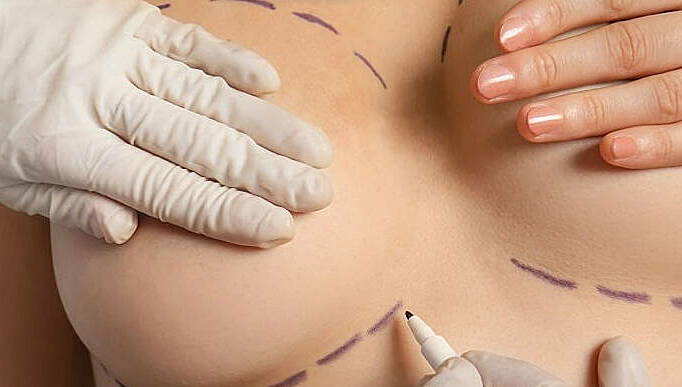Jun Vũ khoe lưng trần gây sốt, quay lại càng khiến dân tình ngỡ ngàng: Nâng ngực thăng hạng visual, nhiều mỹ nhân sau sinh cũng làm và chưa từng hối hận- Ảnh 11. Jun Vũ khoe lưng trần gây sốt, quay lại càng khiến dân tình ngỡ ngàng: Nâng ngực thăng hạng visual, nhiều mỹ nhân mitom bong da truc tiep cũng làm và chưa từng hối hận- Ảnh 11.