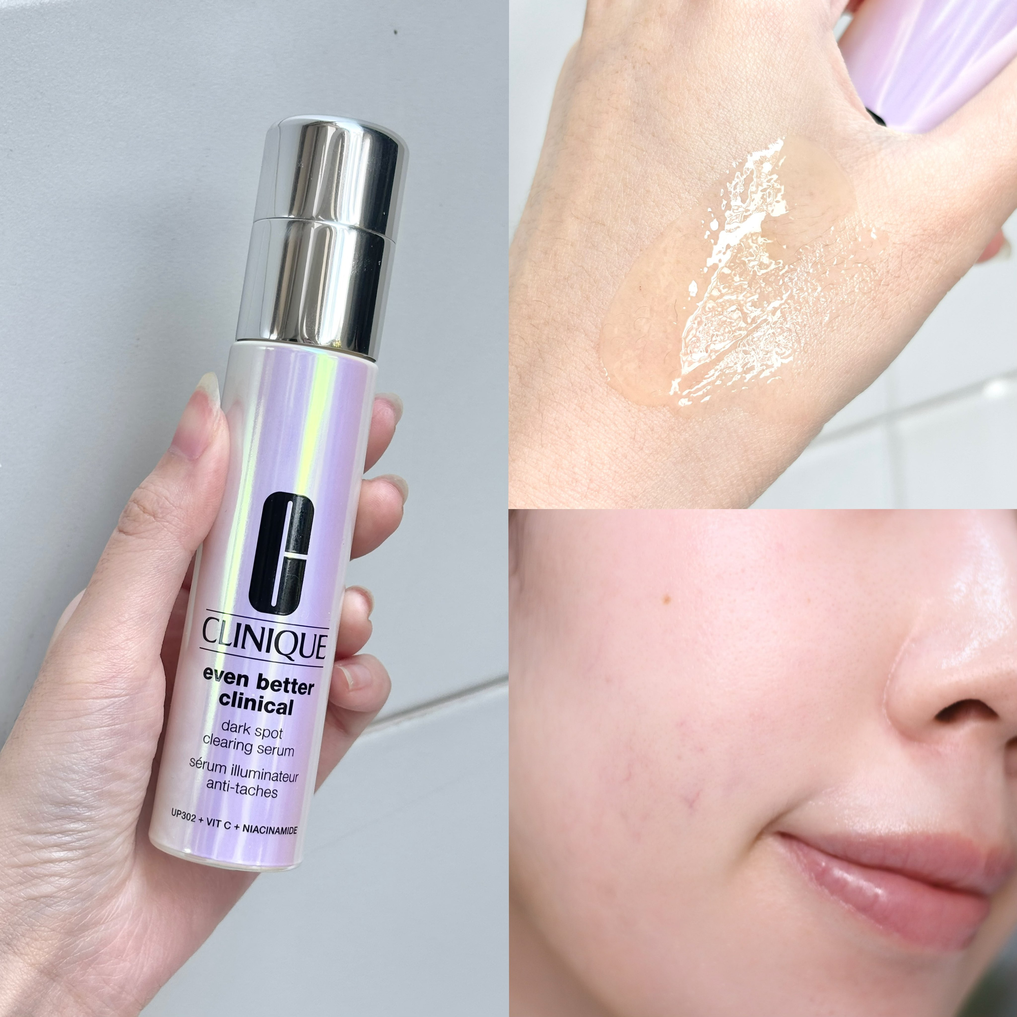 5 serum mờ thâm, giảm nám 5 serum mờ thâm, giảm nám