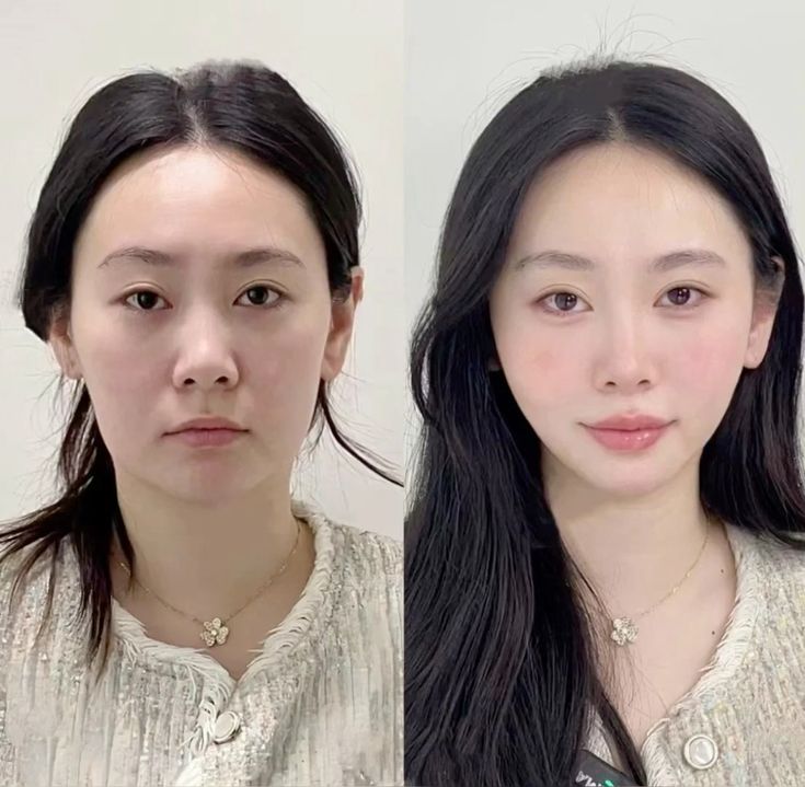 Cái giá của nhan sắc: Phẫu thuật hay chăm sóc tự nhiên?- Ảnh 2. Cái giá của nhan sắc: Phẫu thuật hay chăm sóc tự nhiên?- Ảnh 2.
