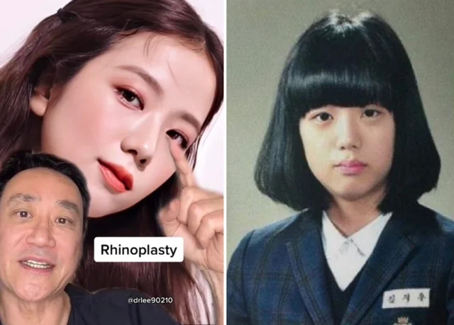 BLACKPINK và visual long lanh vươn tầm quốc tế: 4 thành viên đều chung 1 quyết định đúng đắn để có nhan sắc bạc tỷ!- Ảnh 2. BLACKPINK và visual long lanh vươn tầm quốc tế: 4 thành viên đều chung 1 quyết định đúng đắn để có nhan sắc bạc tỷ!- Ảnh 2.