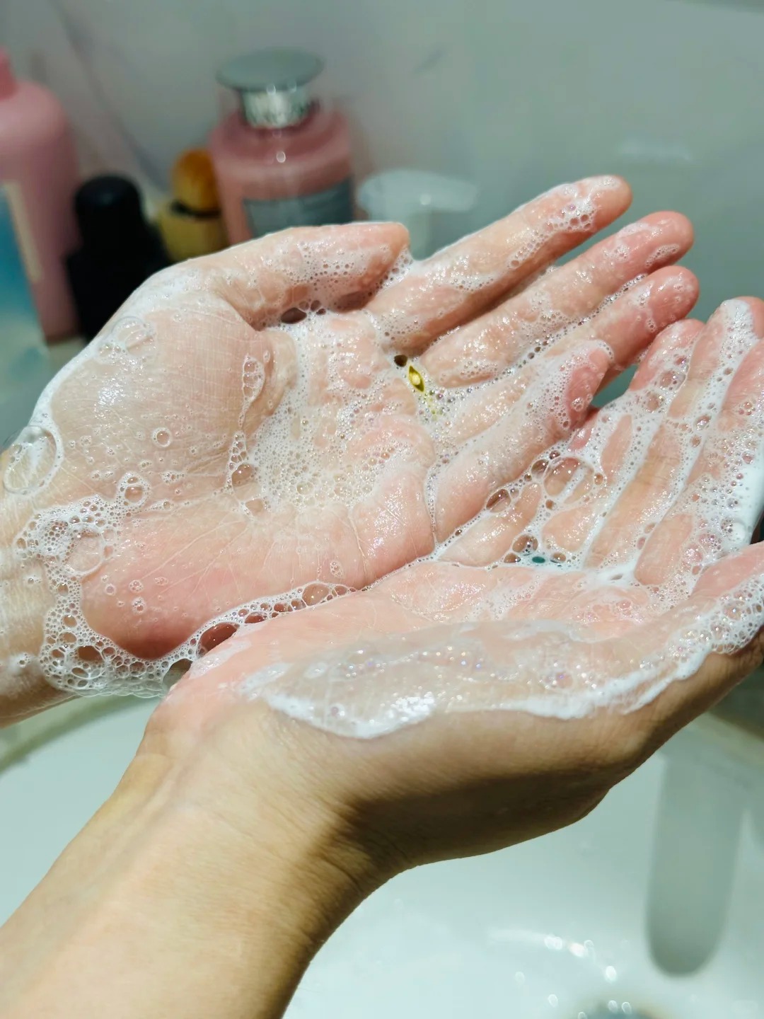 Thay đổi cách rửa mặt, lỗ chân lông của tôi nhỏ hẳn lại và da "đẹp lên trông thấy"- Ảnh 2.