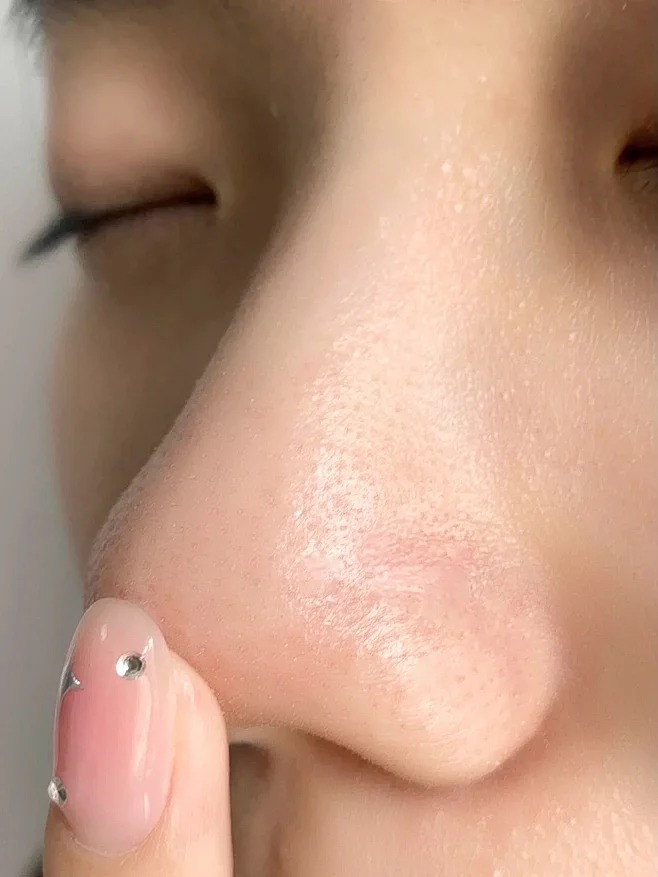 Thay đổi cách rửa mặt, lỗ chân lông của tôi nhỏ hẳn lại và da "đẹp lên trông thấy"- Ảnh 6.