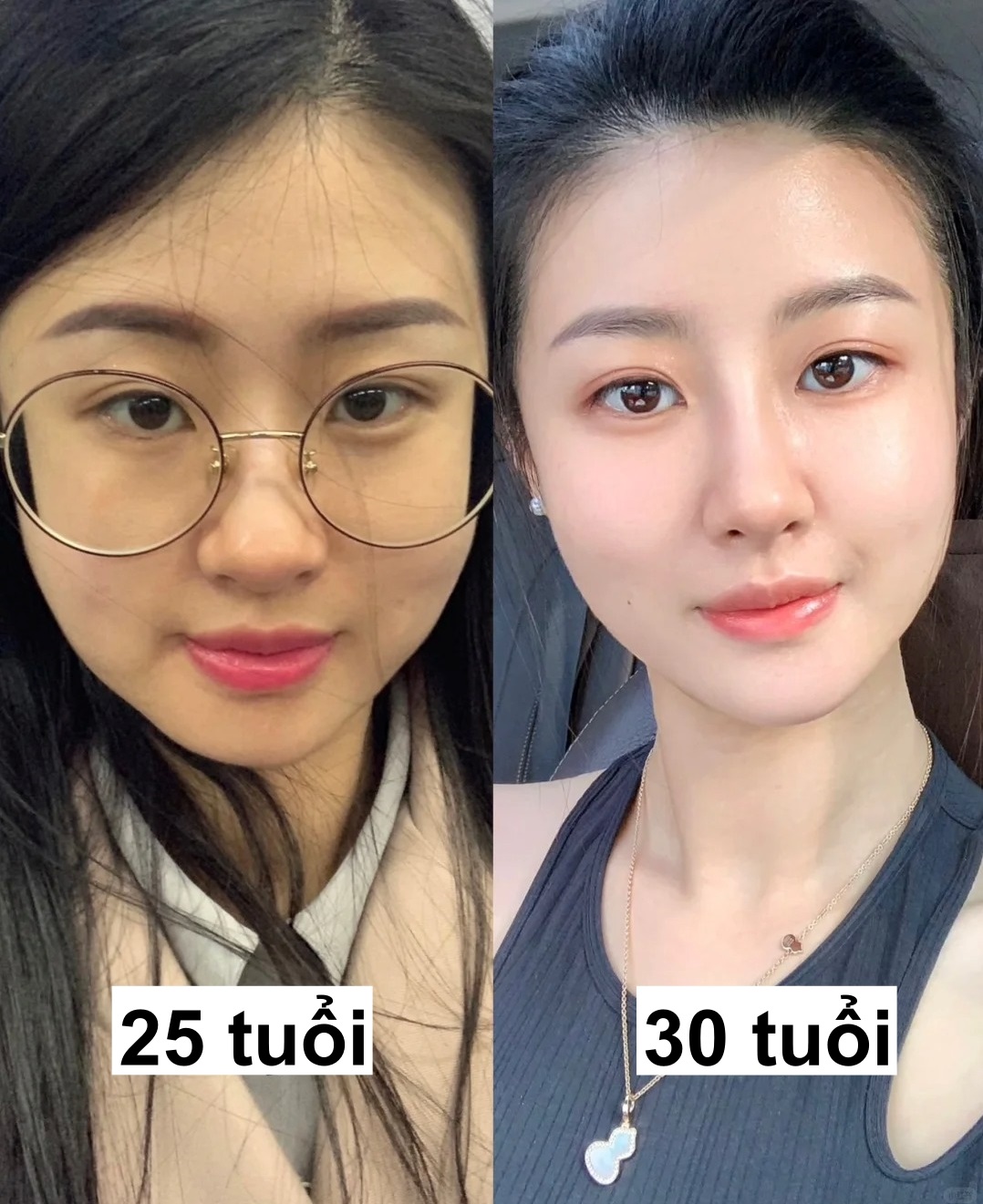 Cách "trẻ hóa da" của cô gái Trung: Càng lớn tuổi da càng đẹp khó tin- Ảnh 1.