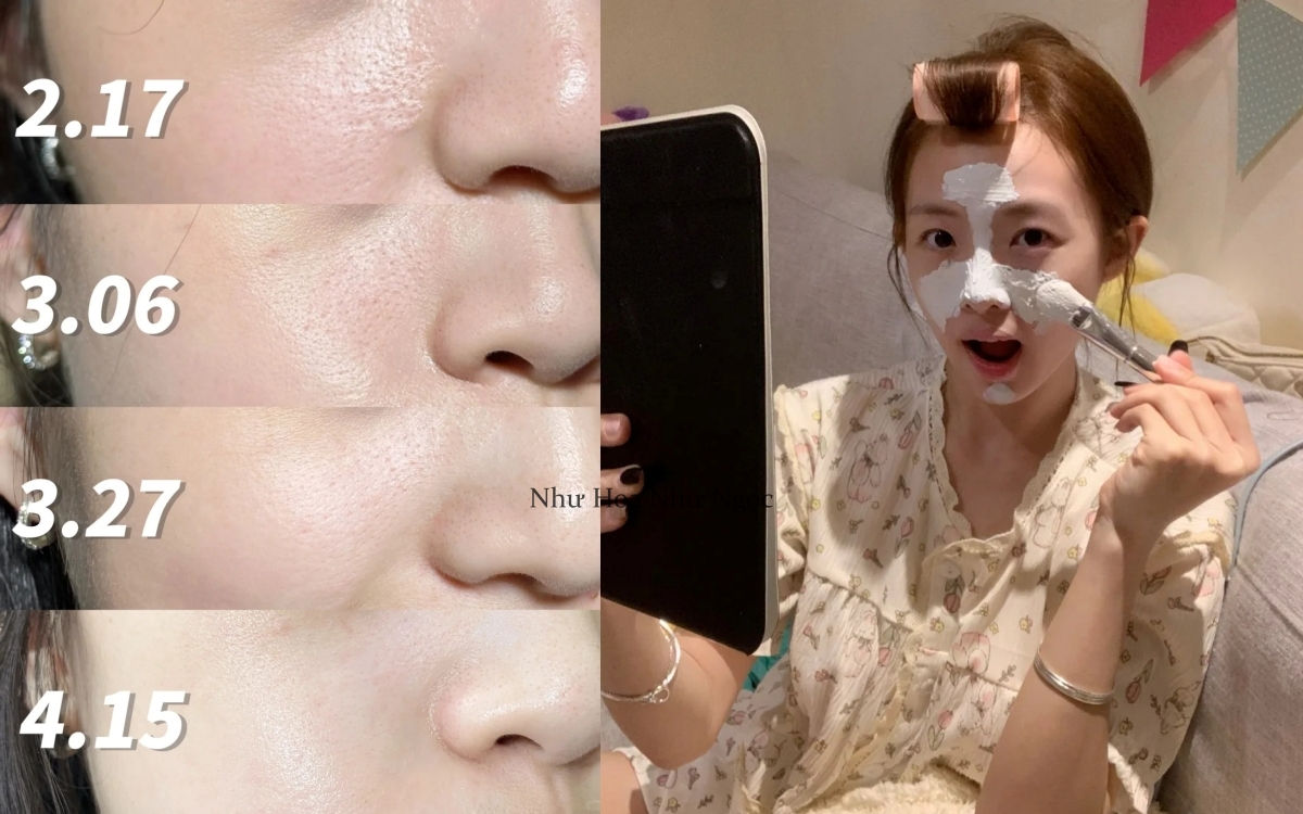 Lỗ chân lông nhỏ đi thấy rõ từ khi tôi đắp loại mặt nạ này mỗi tuần- Ảnh 2.