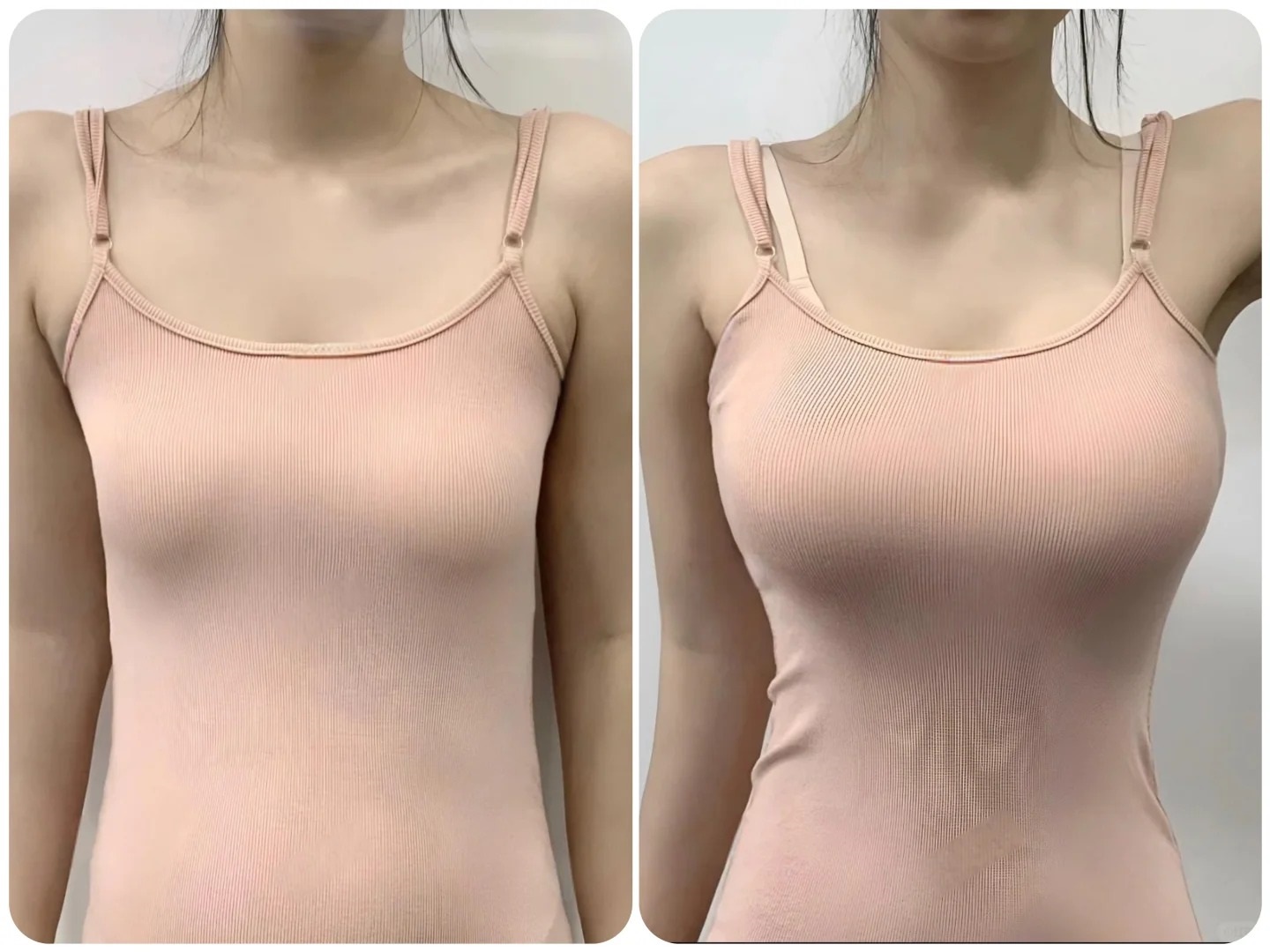Bác sĩ cảnh báo: Những rủi ro khi nâng ngực sai kỹ thuật- Ảnh 2.