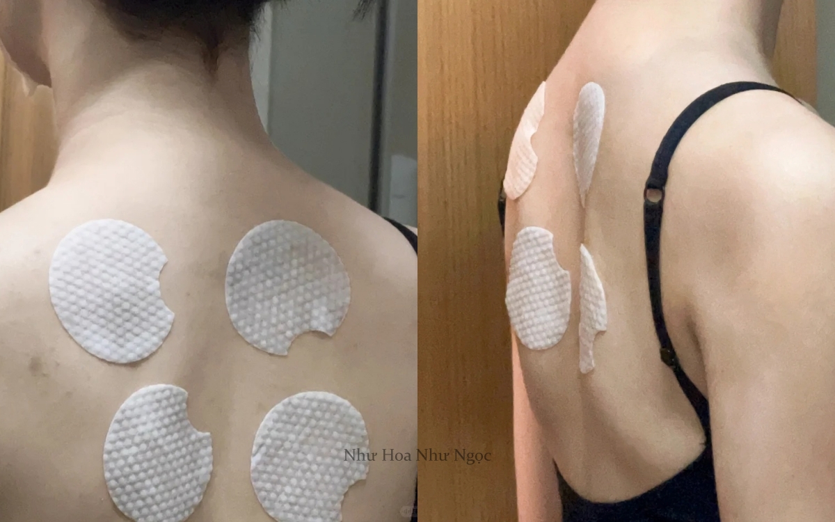 Từ mụn sần sùi, lưng tôi đã "nhẵn nhụi" hoàn toàn nhờ món đồ rẻ tiền này!- Ảnh 3. Từ mụn sần sùi, lưng tôi đã "nhẵn nhụi" hoàn toàn nhờ món đồ rẻ tiền này!- Ảnh 3.