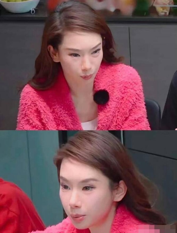 Nữ diễn viên nổi tiếng thừa nhận gương mặt "cứng đờ" vì tiêm botox quá liều, bác sĩ cảnh báo: 0,00000005 gram chất này có thể gây tử vong- Ảnh 2. Nữ diễn viên nổi tiếng thừa nhận gương mặt "cứng đờ" vì tiêm botox quá liều, bác sĩ cảnh báo: 0,00000005 gram chất này có thể gây tử vong- Ảnh 2.