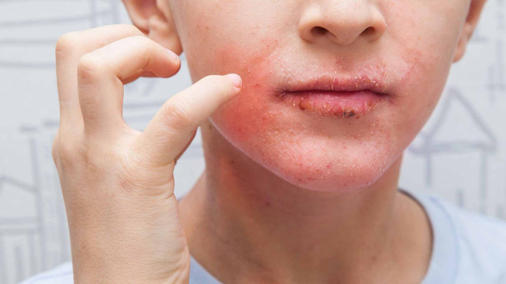 Người c&oacute; gan yếu thường c&oacute; 4 điểm chung tr&ecirc;n khu&ocirc;n mặt: C&oacute; 1 cũng n&ecirc;n đi kh&aacute;m ngay!- Ảnh 3.