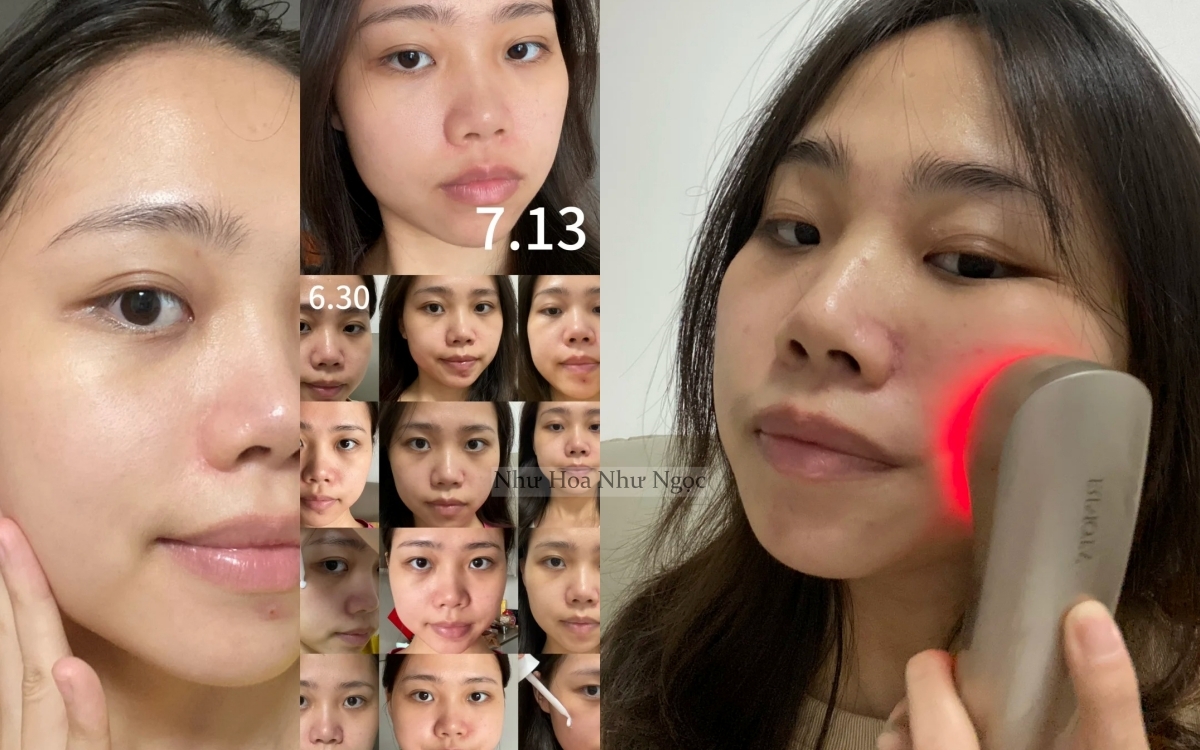 7 tháng tự dưỡng trắng da tại nhà, cô nàng nhận kết quả không thể mỹ mãn hơn- Ảnh 3. 7 tháng tự dưỡng trắng da tại nhà, cô nàng nhận kết quả không thể mỹ mãn hơn- Ảnh 3.
