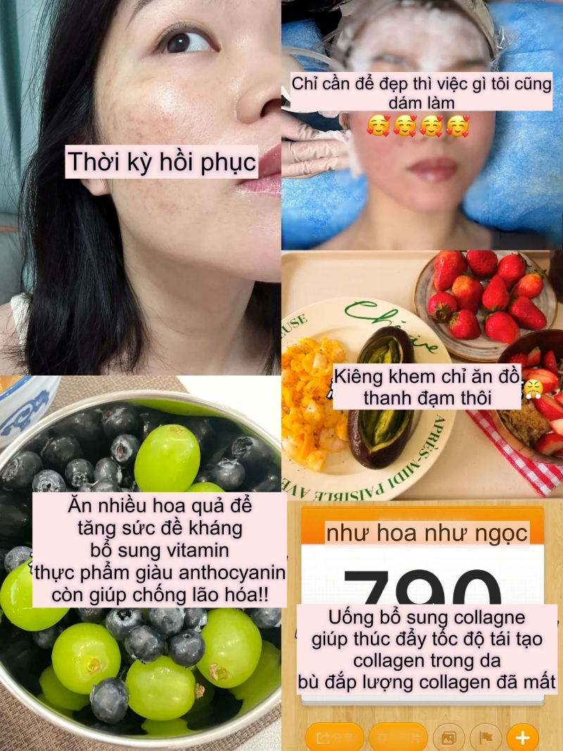 Tôi đã trẻ hóa da thành công nhờ collagen, mất đúng 2 năm để thay đổi làn da sẹo rỗ- Ảnh 4. Tôi đã trẻ hóa truc tiep bong da vtv6 thành công nhờ collagen, mất đúng 2 năm để thay đổi làn truc tiep bong da vtv6 sẹo rỗ- Ảnh 4.