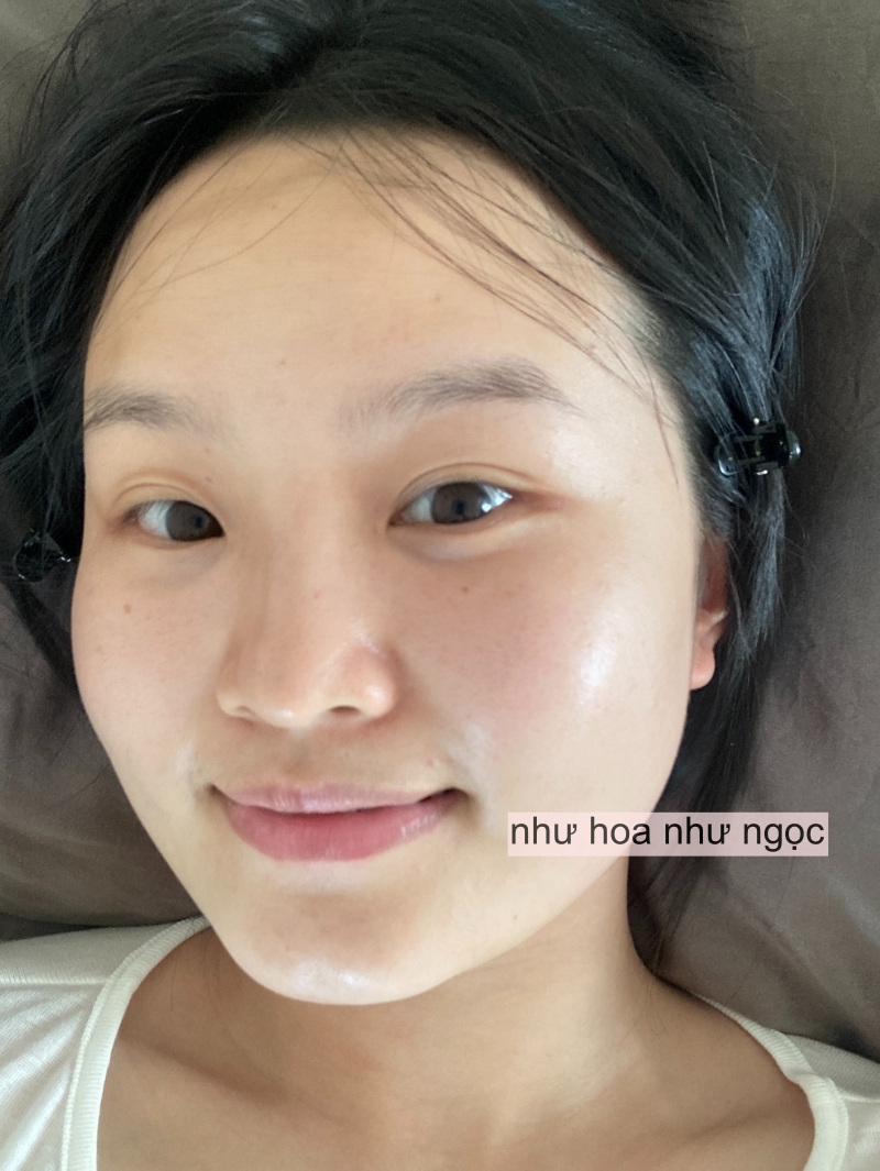 Uống thôi chưa đủ, làn da tuổi 30+ sẽ cần thêm bước này để “đẩy” k+ truc tiep bong da vào sâu- Ảnh 4.