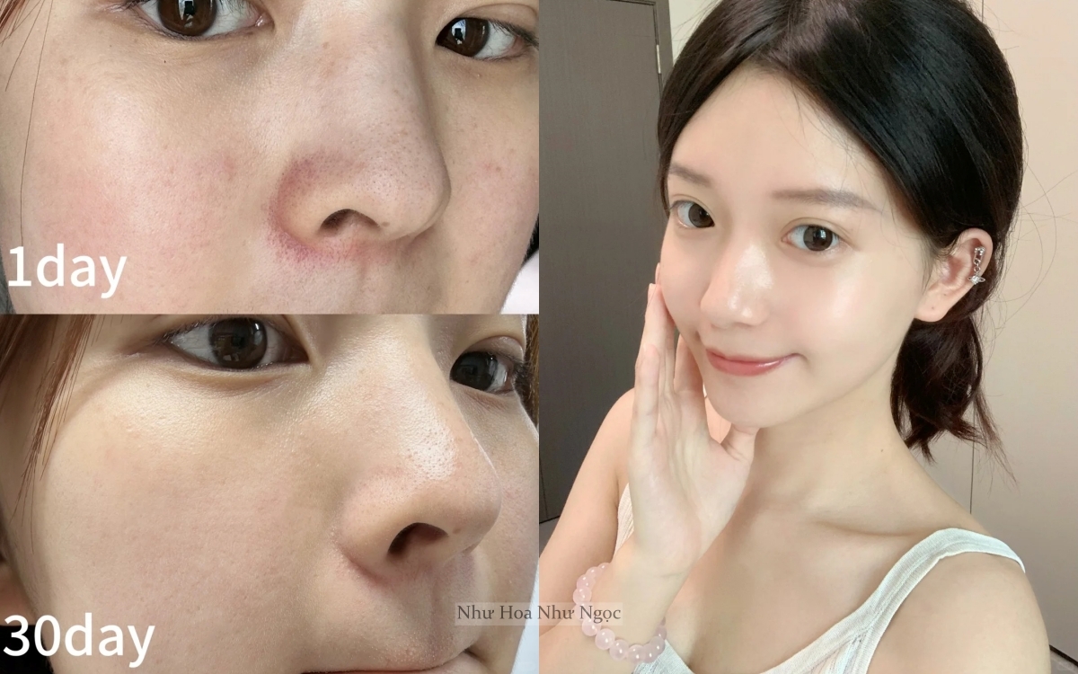 Không chạy theo xu hướng da "trắng sứ", tuổi 35+ tôi nhận ra rằng chỉ cần dưỡng đúng cách thì da sẽ sáng mịn từ bên trong- Ảnh 1. Không chạy theo xu hướng da "trắng sứ", tuổi 35+ tôi nhận ra rằng chỉ cần dưỡng đúng cách thì da sẽ sáng mịn từ bên trong- Ảnh 1.