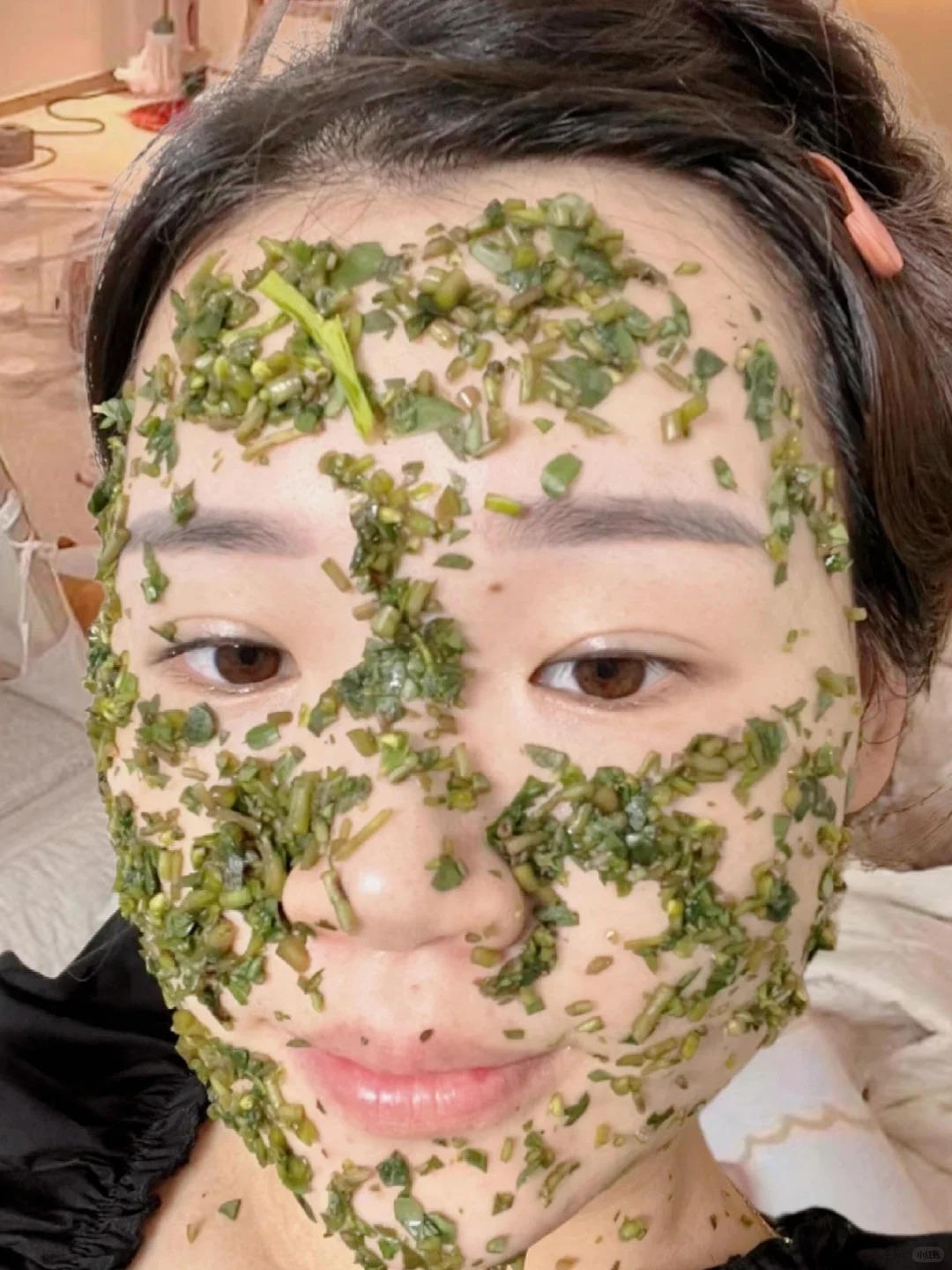 Tôi đắp rau sam mỗi ngày và nám mờ dần đi lúc nào không hay- Ảnh 2. Tôi đắp rau sam mỗi ngày và nám mờ dần đi lúc nào không hay- Ảnh 2.