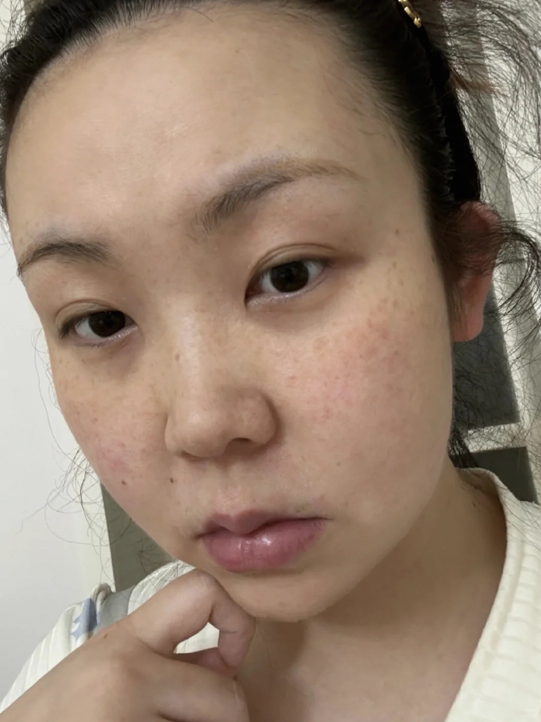 Tôi đắp rau sam mỗi ngày và nám mờ dần đi lúc nào không hay- Ảnh 3. Tôi đắp rau sam mỗi ngày và nám mờ dần đi lúc nào không hay- Ảnh 3.