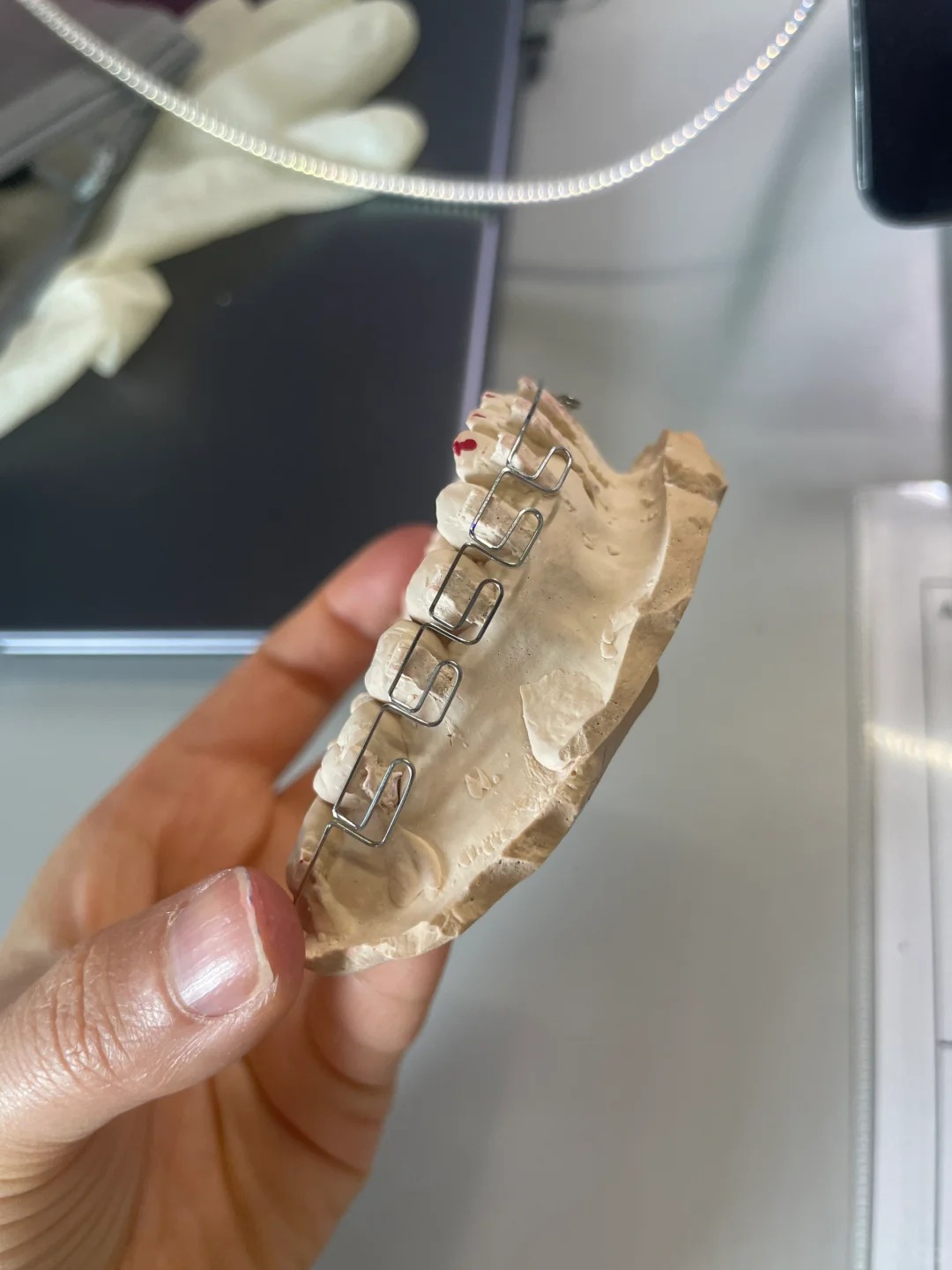 Chỉnh nha kiểu Meaw - Geaw: Vì sao được giới trẻ săn đón?- Ảnh 3. Chỉnh nha kiểu Meaw - Geaw: Vì sao được giới trẻ săn đón?- Ảnh 3.