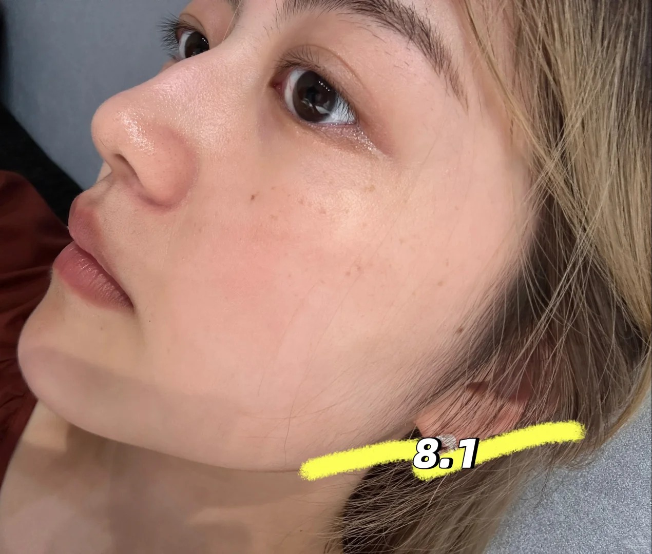 Lỗ chân lông nhỏ đi thấy rõ sau 1 tháng cô nàng này dùng bộ đôi serum dưỡng da bình dân của Hàn- Ảnh 3. Lỗ chân lông nhỏ đi thấy rõ sau 1 tháng cô nàng này dùng bộ đôi serum dưỡng da bình dân của Hàn- Ảnh 3.