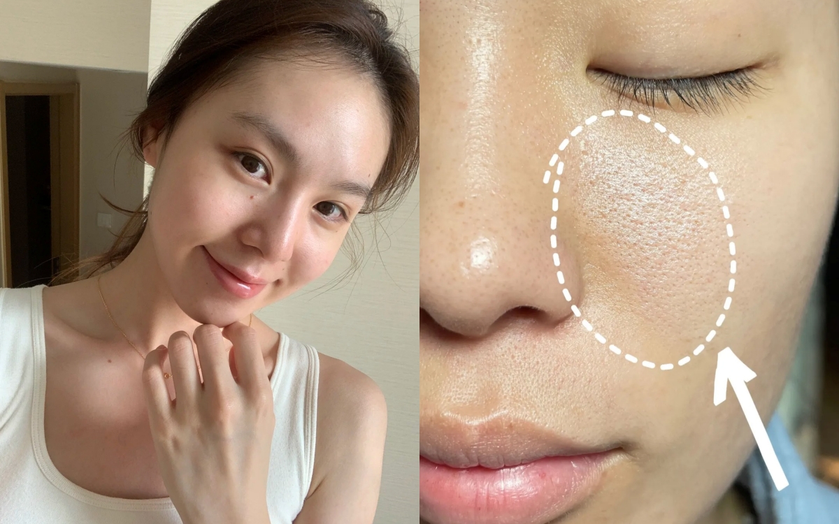 Lỗ chân lông nhỏ đi thấy rõ sau 1 tháng cô nàng này dùng bộ đôi serum dưỡng da bình dân của Hàn- Ảnh 1. Lỗ chân lông nhỏ đi thấy rõ sau 1 tháng cô nàng này dùng bộ đôi serum dưỡng da bình dân của Hàn- Ảnh 1.