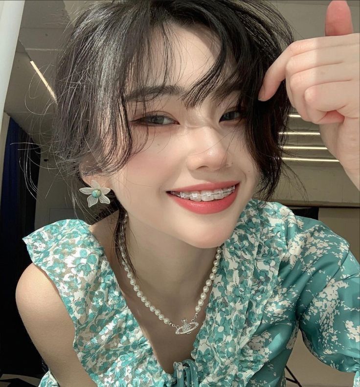 Niềng răng sai cách: Gây lệch mặt, sưng hàm, đau khớp- Ảnh 2. Niềng răng sai cách: Gây lệch mặt, sưng hàm, đau khớp- Ảnh 2.