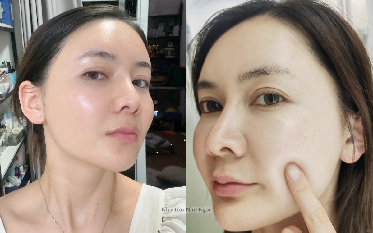 Thạc sĩ 36 tuổi chia sẻ hành trình trị mụn ẩn khoa học: Da sần sùi hóa láng mịn chỉ nhờ hiểu đúng- Ảnh 3.