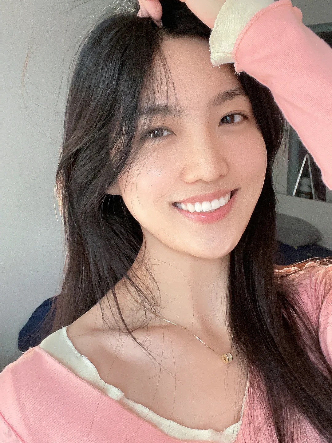Đừng để răng sứ "làm hỏng nụ cười" khi mắc phải những sai lầm cơ bản này- Ảnh 5. Đừng để răng sứ "làm hỏng nụ cười" khi mắc phải những sai lầm cơ bản này- Ảnh 5.