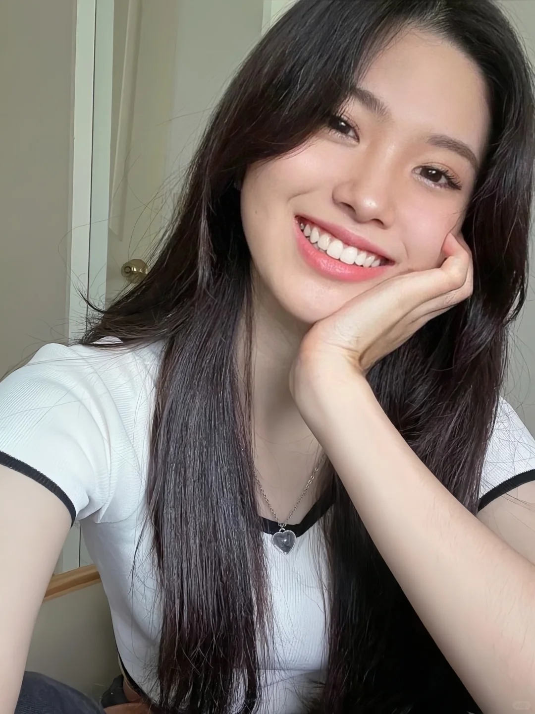 Đừng để răng sứ "làm hỏng nụ cười" khi mắc phải những sai lầm cơ bản này- Ảnh 7. Đừng để răng sứ "làm hỏng nụ cười" khi mắc phải những sai lầm cơ bản này- Ảnh 7.