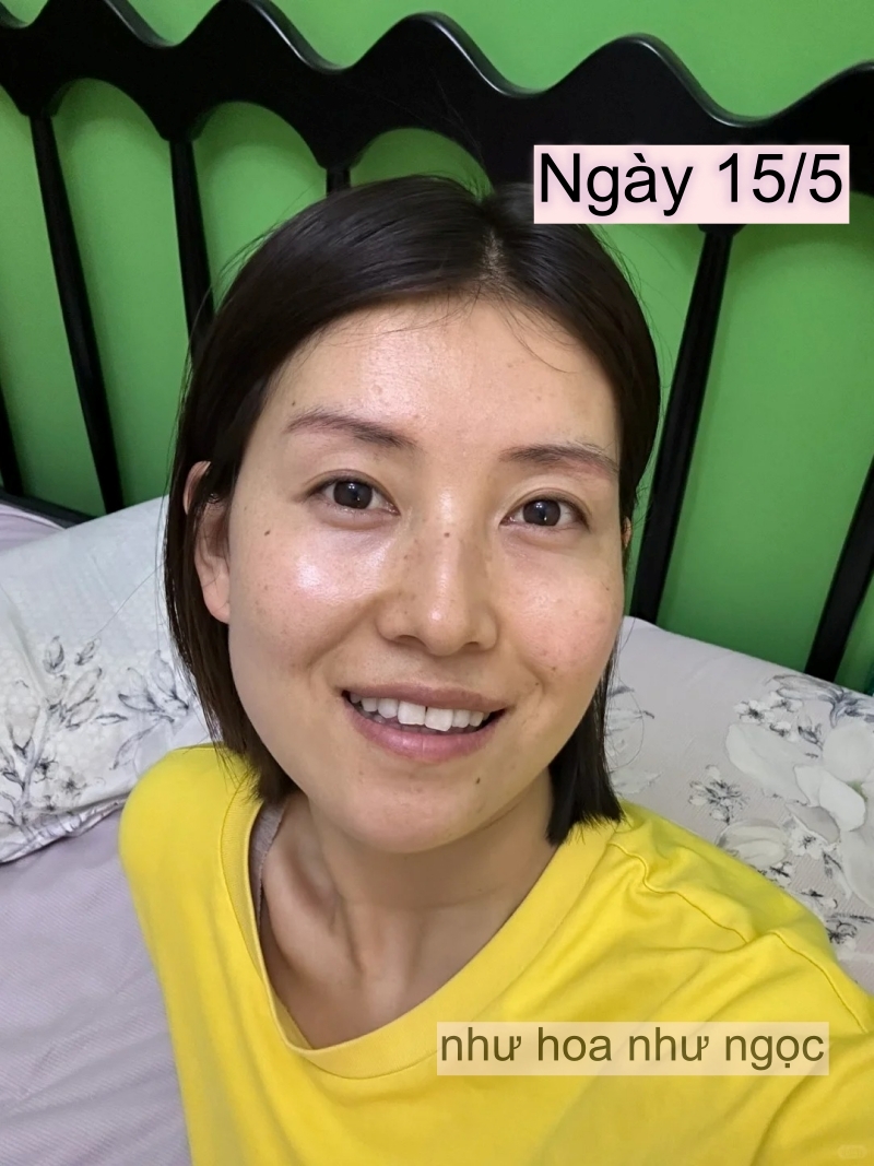 Chụp ảnh mặt mộc hàng ngày trong 1 tháng uống collagen, có điểm này trên mặt thay đổi mà tôi thấy rõ- Ảnh 5. Chụp ảnh mặt mộc hàng ngày trong 1 tháng uống collagen, có điểm này trên mặt thay đổi mà tôi thấy rõ- Ảnh 5.