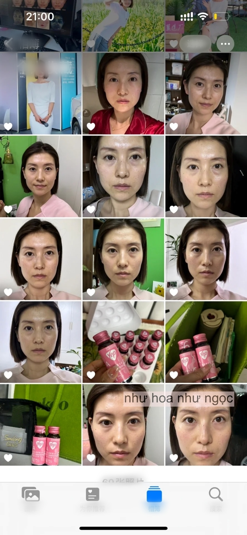 Chụp ảnh mặt mộc hàng ngày trong 1 tháng uống collagen, có điểm này trên mặt thay đổi mà tôi thấy rõ- Ảnh 7. Chụp ảnh mặt mộc hàng ngày trong 1 tháng uống collagen, có điểm này trên mặt thay đổi mà tôi thấy rõ- Ảnh 7.