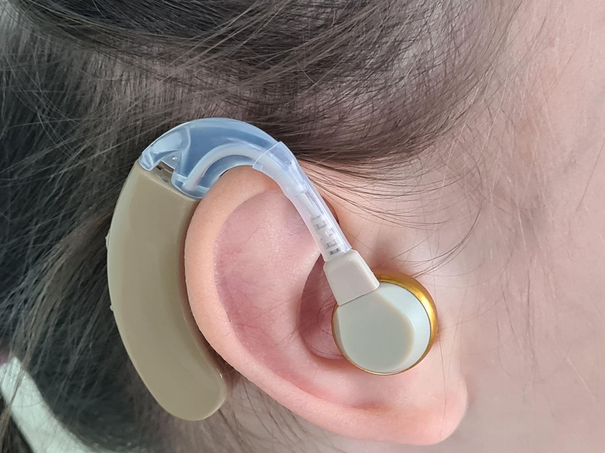 6 bệnh nguy hiểm hàng đầu ở trẻ nhỏ bố mẹ cần bỏ túi kiến thức phòng ngừa- Ảnh 4.