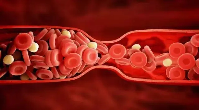 Ăn 3 loại thức ăn thường xuyên, mạch máu sẽ thông - Ảnh 1.