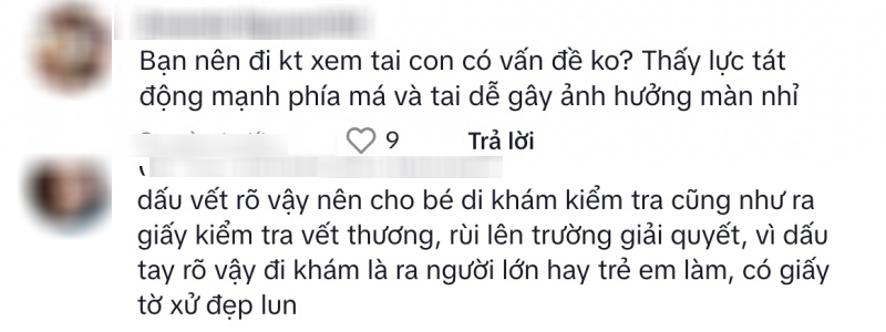 Xôn xao sự việc đón con đi học về thấy in hằn vết tay tấy đỏ khắp mặt, lời giải thích vô lý của giáo viên càng khiến dân tình bức xúc- Ảnh 3.