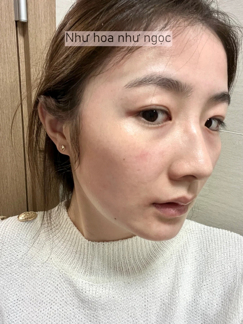 Tôi đã bù đắp lại lượng collagen đã mất bằng cách làm điều này mỗi tối trước khi ngủ- Ảnh 6. Tôi đã bù đắp lại lượng collagen đã mất bằng cách làm điều này mỗi tối trước khi ngủ- Ảnh 6.