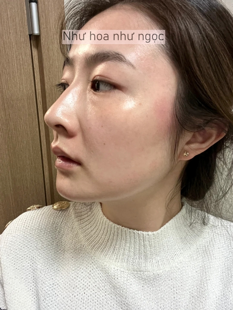 Tôi đã bù đắp lại lượng collagen đã mất bằng cách làm điều này mỗi tối trước khi ngủ- Ảnh 4. Tôi đã bù đắp lại lượng collagen đã mất bằng cách làm điều này mỗi tối trước khi ngủ- Ảnh 4.