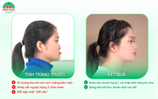 Chắp cánh ước mơ - Thắp sáng hy vọng cho bệnh nhân dị tật/biến dạng hàm mặt- Ảnh 5. Chắp cánh ước mơ - Thắp sáng hy vọng cho bệnh nhân dị tật/biến dạng hàm mặt- Ảnh 5.