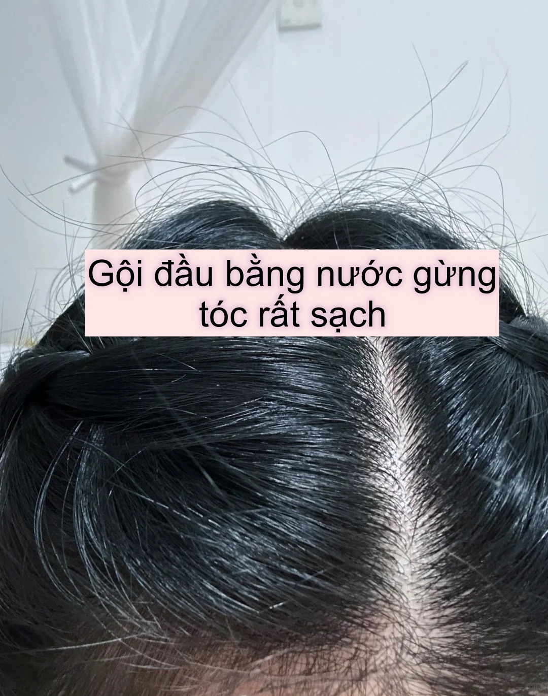 Tôi đun nước gừng để gội đầu, lần đầu tiên tóc rụng kinh khủng nhưng đến lần thứ 3 thì có sự thay đổi đến khó tin- Ảnh 6. Tôi đun nước gừng để gội đầu, lần đầu tiên tóc rụng kinh khủng nhưng đến lần thứ 3 thì có sự bong da truc tiep xoi lac đổi đến khó tin- Ảnh 6.