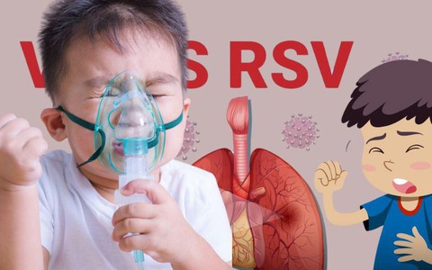 Bé 5 tháng tuổi tử vong vì RSV: Bác sĩ nhi khoa giải đáp những hiểu lầm thường gặp- Ảnh 3. Bé 5 tháng tuổi tử vong vì truc tiep bong da hom nay: Bác sĩ nhi khoa giải đáp những hiểu lầm thường gặp- Ảnh 3.