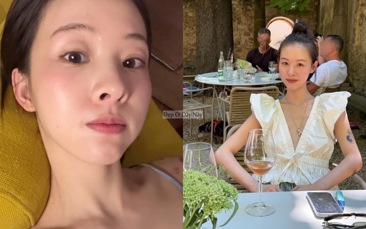 B&iacute; quyết gi&uacute;p da ng&agrave;y một khỏe đẹp từ b&ecirc;n trong của c&ocirc; n&agrave;ng người H&agrave;n Quốc- Ảnh 5.