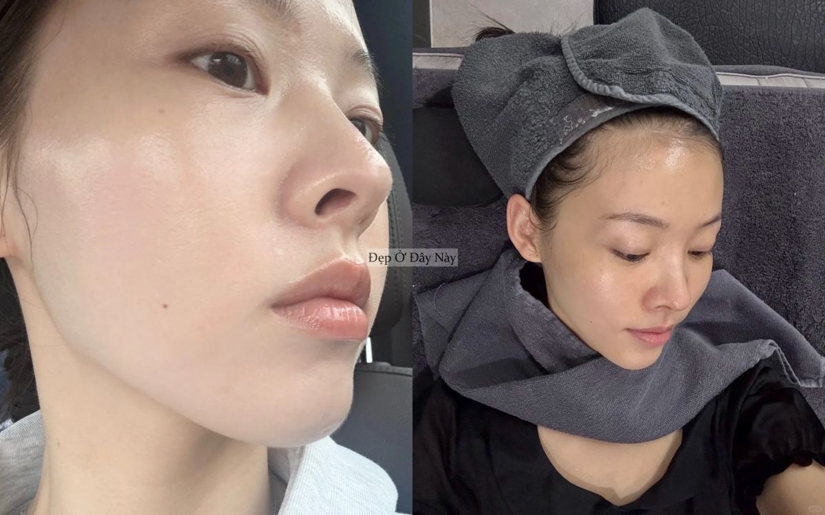 B&iacute; quyết gi&uacute;p da ng&agrave;y một khỏe đẹp từ b&ecirc;n trong của c&ocirc; n&agrave;ng người H&agrave;n Quốc- Ảnh 7.