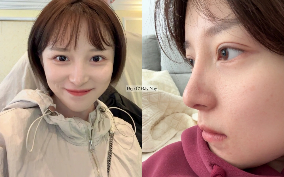 C&ocirc;ng thức dưỡng da "2 nhiều - 1 &iacute;t" gi&uacute;p t&ocirc;i được khen trẻ như g&aacute;i 18- Ảnh 1.