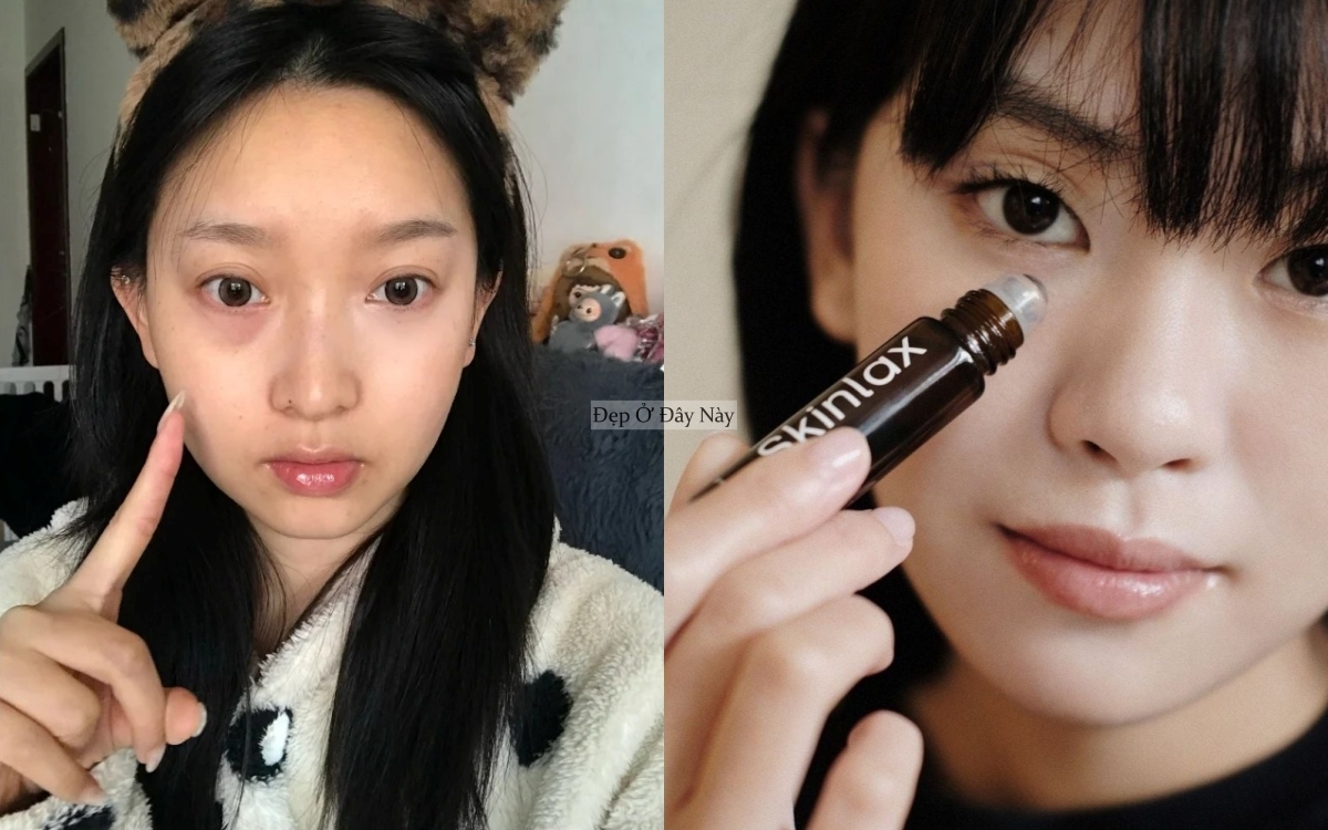 4 dưỡng mắt "made in Vietnam" gi&uacute;p giảm quầng th&acirc;m thấy r&otilde;- Ảnh 1.