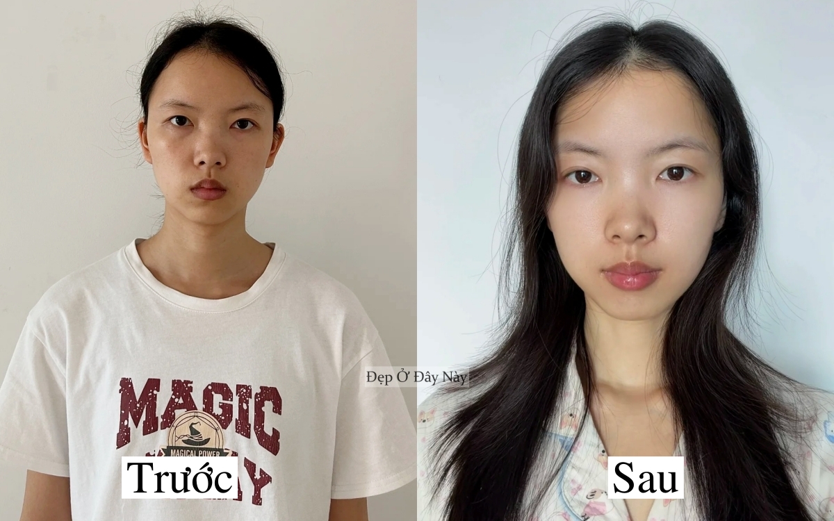 C&ocirc; g&aacute;i như đổi mặt ho&agrave;n to&agrave;n nhờ chi&ecirc;u dưỡng da "0 đồng" tại nh&agrave;- Ảnh 2.