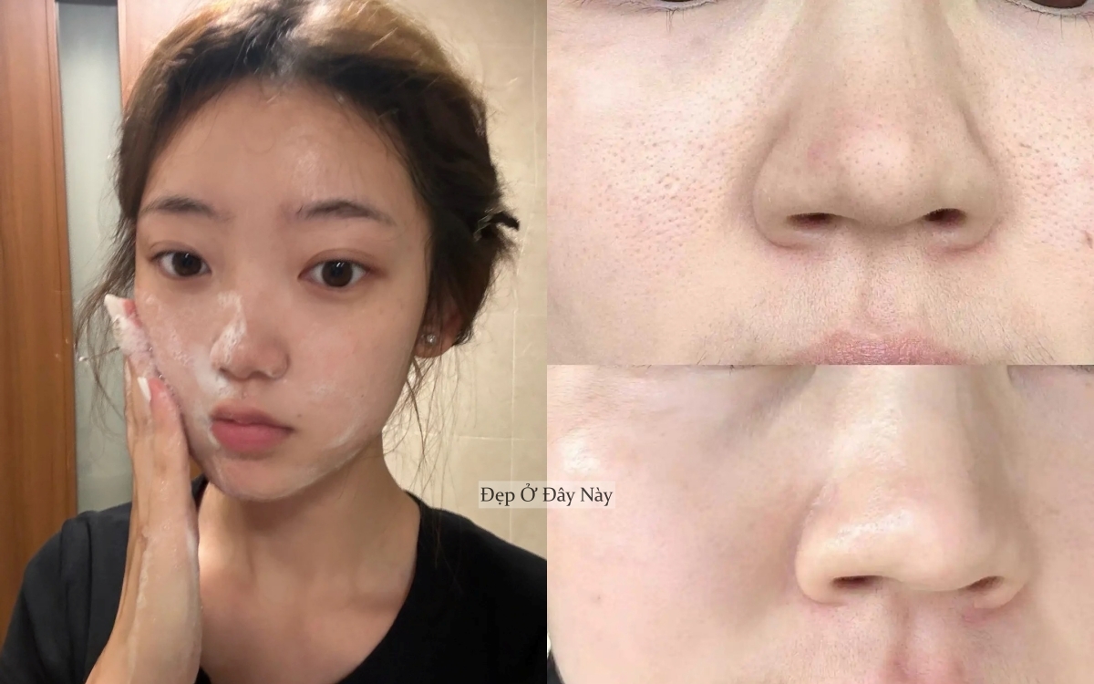 Muốn lỗ ch&acirc;n l&ocirc;ng bớt to, t&ocirc;i khuy&ecirc;n bạn n&ecirc;n bắt đầu từ sữa rửa mặt- Ảnh 1.