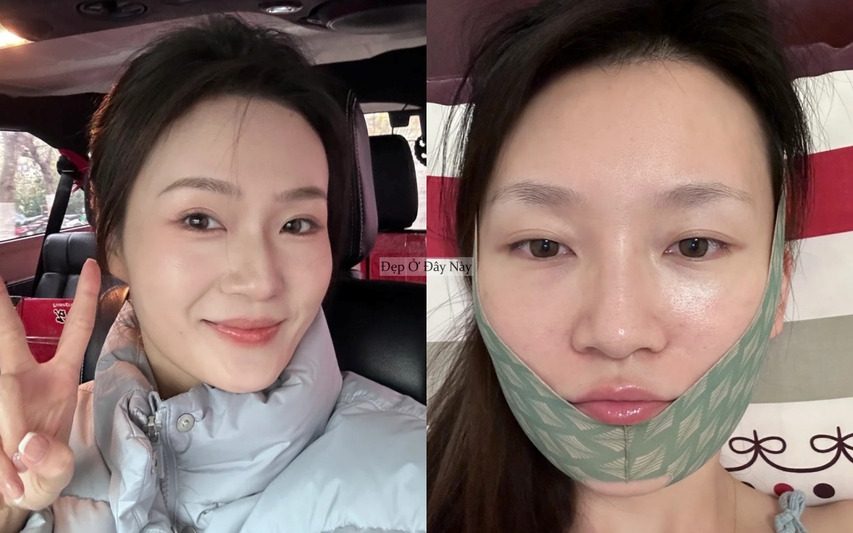 Trước Tết 7 ng&agrave;y, t&ocirc;i l&agrave;m đ&uacute;ng 5 việc n&agrave;y để mặt gọn lại v&agrave; da căng b&oacute;ng hơn hẳn- Ảnh 1.